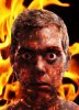 burnt face.jpg