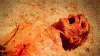 Dehydration-lg.gif