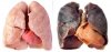 Tips To Clean The Lungs Of Smokers (2).jpg