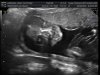 BABY  D_15.jpg