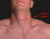 adams_apple_1225706156.jpg