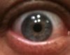 eye.JPG
