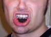 Dipping_tobacco_in_mouth.jpg
