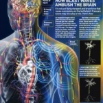 How Blast Waves Ambush the Brain

Itâ€™s not just flying shrapnel and brute force that cause concussions on the battlefield. Pressure waves may also play a role. Hereâ€™s how
An explosion begins with a powerful pulse of hot compressed gas that radiates outward, generating a wave of pressure that can travel up to 1,500 mph. The bigger the bomb, the faster and more forceful the wave. A vacuum of air trails this initial wave, creating a violent suction force that can shear organs.
But little is known about how blast waves damage the brain. Shock waves rattle the head but may also compress the torso, transferring energy to blood vessels. One theory is that the oscillating waves travel through the bloodstream and into the brain, where they twist and kill neurons over time.
Eric Hagerman is a contributing editor for Popular Science.