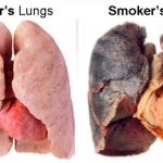 lungs   vaper vs smoker