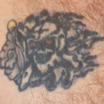 Chest tat