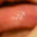 050312lip