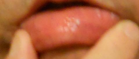050312lip