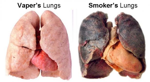 lungs   vaper vs smoker