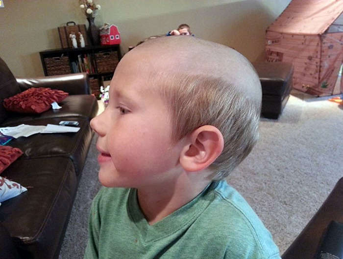 male-pattern-bald-haircut-kid.jpg
