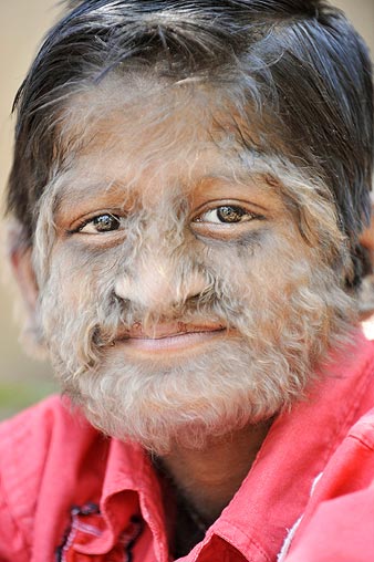 werewolf-boy-close-_671234n.jpg