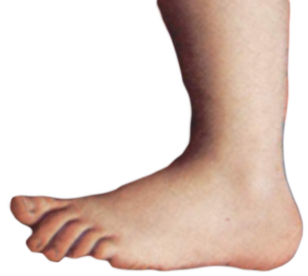 Monty_python_foot.png