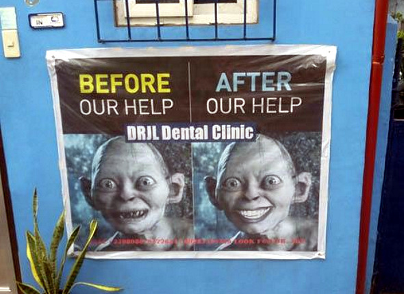 gollum-dental-work.jpg